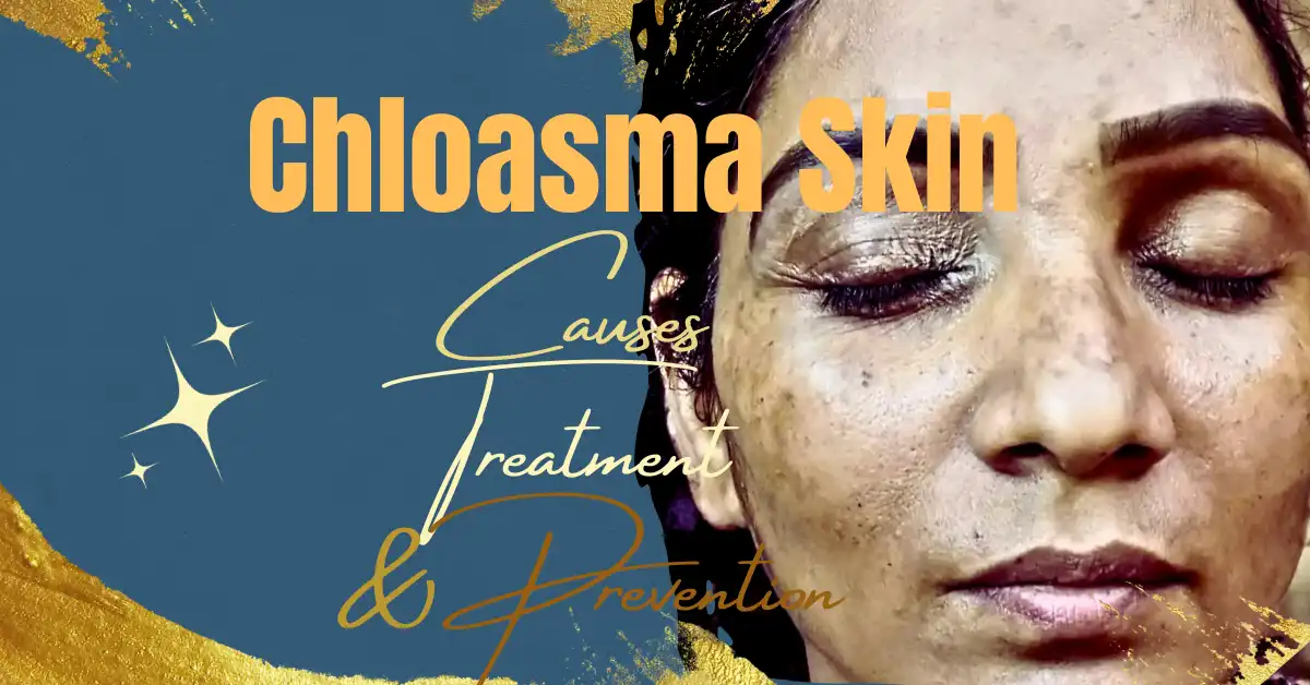 Chloasma Skin