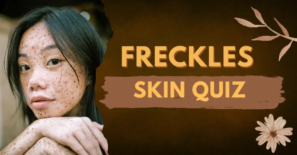 Freckles skin quiz